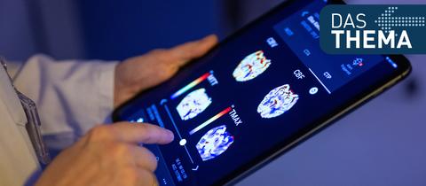 Radiologin im Unfallkrankenhaus Berlin betrachtet in einer KI-basierten App auf einem Tablet Gehirnbilder eines Patienten.