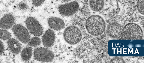 Diese elektronenmikroskopische Aufnahme aus dem Jahr 2003, die von den Centers for Disease Control and Prevention zur Verfügung gestellt wurde, zeigt reife, ovale Affenpockenviren (l) und kugelförmige unreife Virionen (r), die aus einer menschlichen Hautprobe im Zusammenhang mit dem Präriehundeausbruch von 2003 stammt. 
