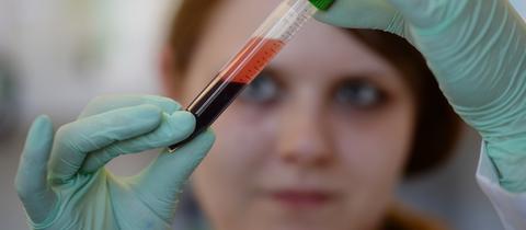 Eine medizinisch technische Assistentin üebrprüft eine Blutprobe