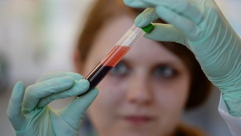 Eine medizinisch technische Assistentin üebrprüft eine Blutprobe